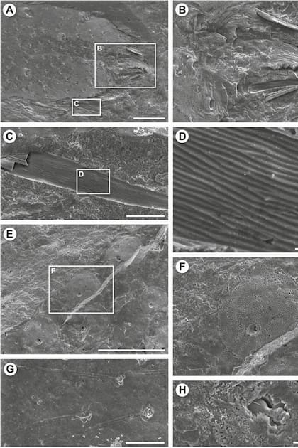 El detalle de las microfotografías que se le sacaron al ejemplar de araña fosilizado que fue hallado en Australia