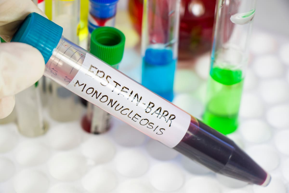 El diagnóstico oportuno con una prueba de anticuerpos permite dar indicaciones clínicas adecuadas para evitar complicaciones