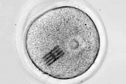El diminuto chip, cuya forma recuerda a los paneles solares de la estación espacial internacional, aunque es más fino que un coronavirus, en el interior de un óvulo