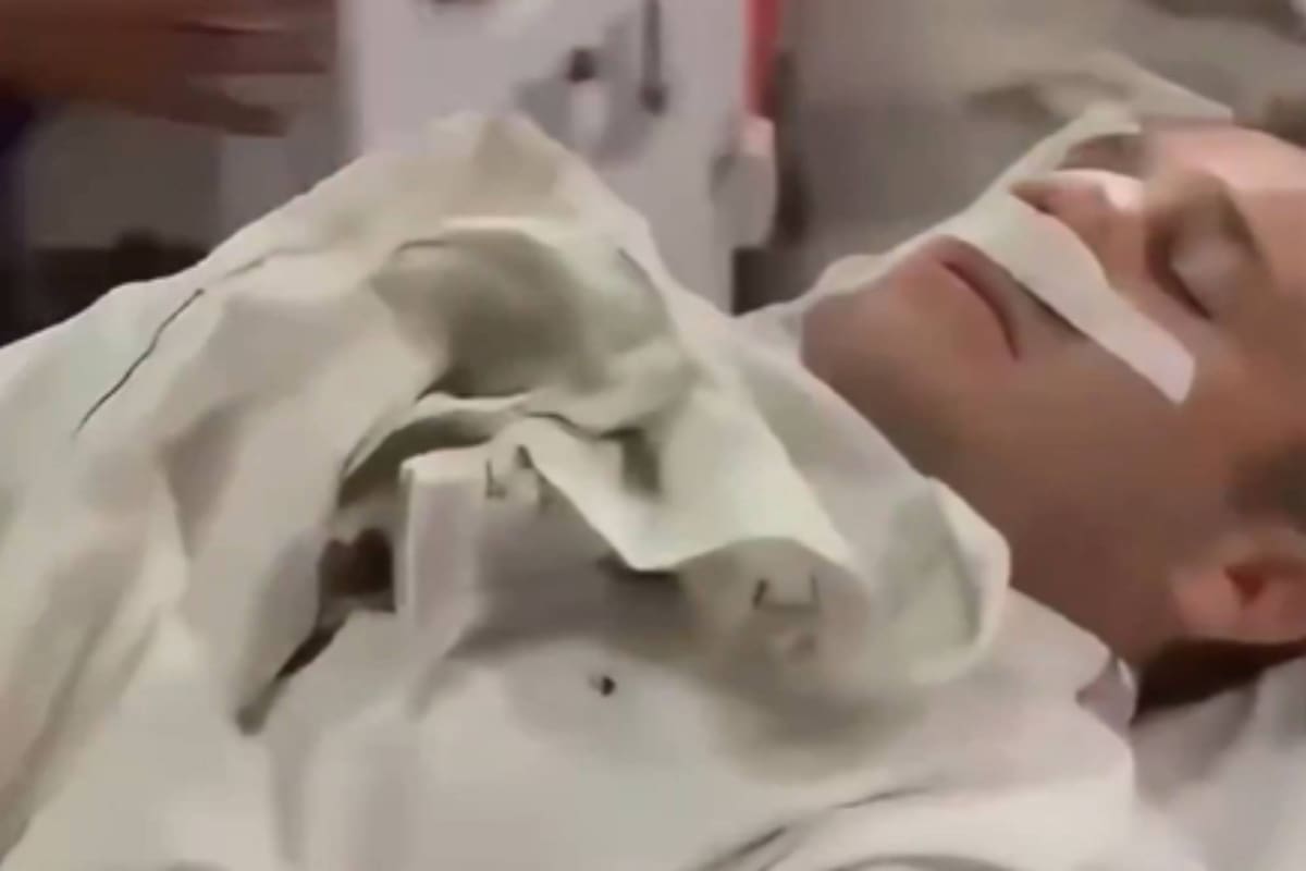El diputado tucumano fue agredido por un presunto puntero político del ministro de Interior de Jaldo.