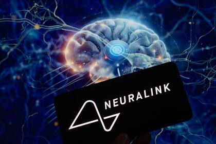 El dispositivo de Neuralink transmite la actividad cerebral de forma inalámbrica.