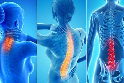 El dolor de espalda afecta a más del 80 % de la población en algún momento de su vida