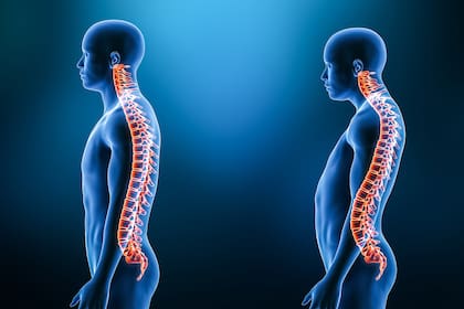 El dolor de espalda relacionado con la computadora no es infrecuente: un estudio de 2021 de 2000 personas que trabajaban con computadoras encontró que el 48 por ciento de los consultados tenía dolor en esta parte del cuerpo y tambióen en el cuello