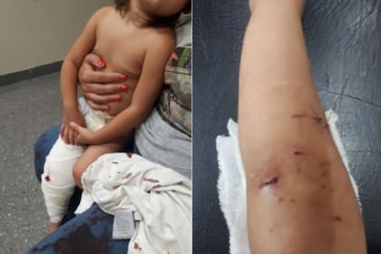 El dueño del pitbull pidió disculpas a los familiares de la nena atacada