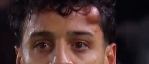 El duro golpe que obligó a Tiago Palacios a salir de la cancha en el partido de Estudiantes