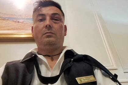 El empleado golpeado por un huésped del Alvear Palace Hotel