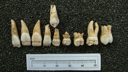 "El esmalte de la mayoría de los dientes está lleno de hoyos y otros defectos, que ocurren si el niño no se encuentra bien o está desnutrido", explicó Rebecca Gowland
