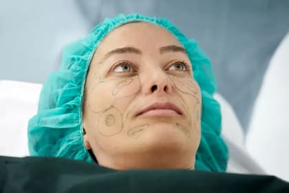 El estiramiento facial requiere hacer incisiones a ambos lados del rostro