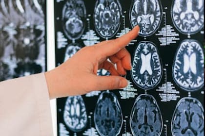 El estrés o la ansiedad pueden ser algunos de los principales motivos de alteración de la capacidad cognitiva (Foto Pexels)