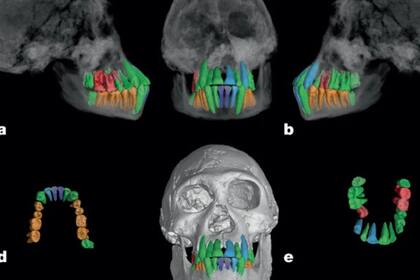 El estudio analizó la dentadura para encontrar respuestas (Foto: Nature)