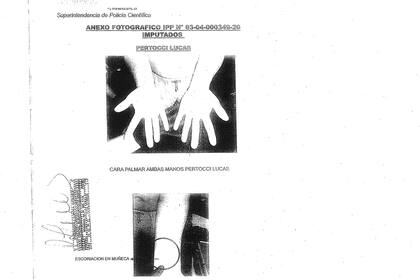 El expediente de la causa con fotos de las lesiones de Lucas Pertossi