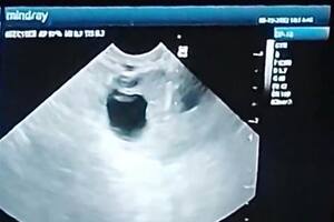 El fiscal platense Martín Almirón procesó y citó a declaración indagatoria a los propietarios de la Clínica de Fertilidad Eclos
