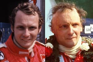 Así contó Niki Lauda el accidente que quemó su cuerpo: la extremaunción y el reencuentro con el espejo