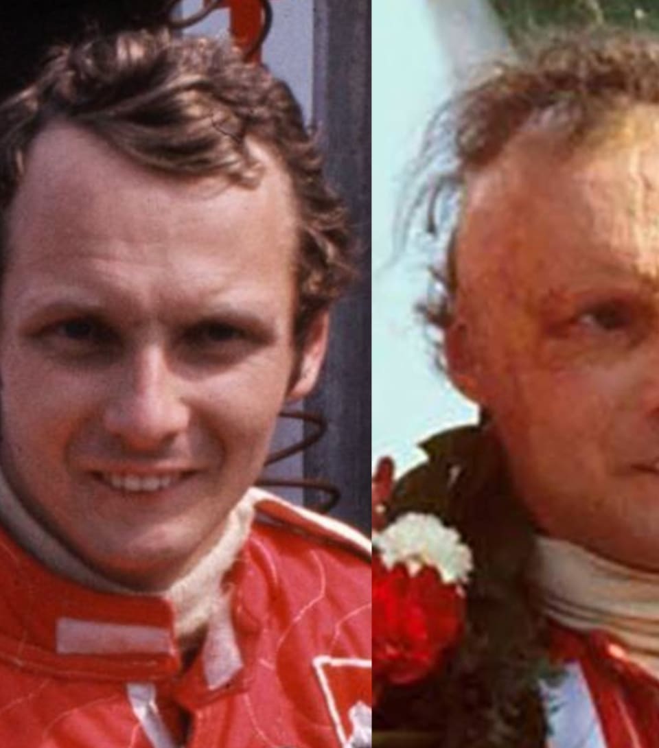 Niki Lauda fue campeón del mundo de la Fórmula 1 tres veces, dos de ellas fueron después del accidente que casi le cuesta la vida