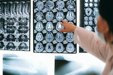 Un tumor que puede resistir a la cirugía, la radioterapia y la quimio desafía a los médicos: las nuevas alternativas