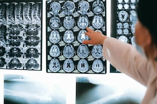 Un tumor que puede resistir a la cirugía, la radioterapia y la quimio desafía a los médicos: las nuevas alternativas