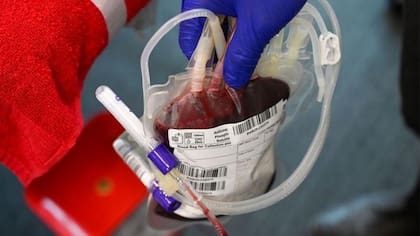 El grupo sanguíneo Rh nulo es extremadamente raro pero muy útil desde el punto de vista médico