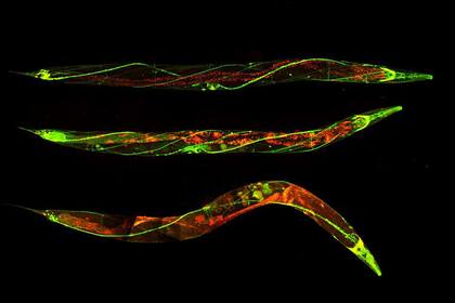 El gusano 'C. elegans' tiene un sistema nervioso muy similar al de los seres humanos