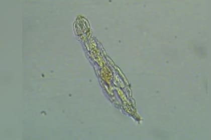 El hallazgo de la bacteria sorprendió a los investigadores (Foto: gentileza Paun VI)