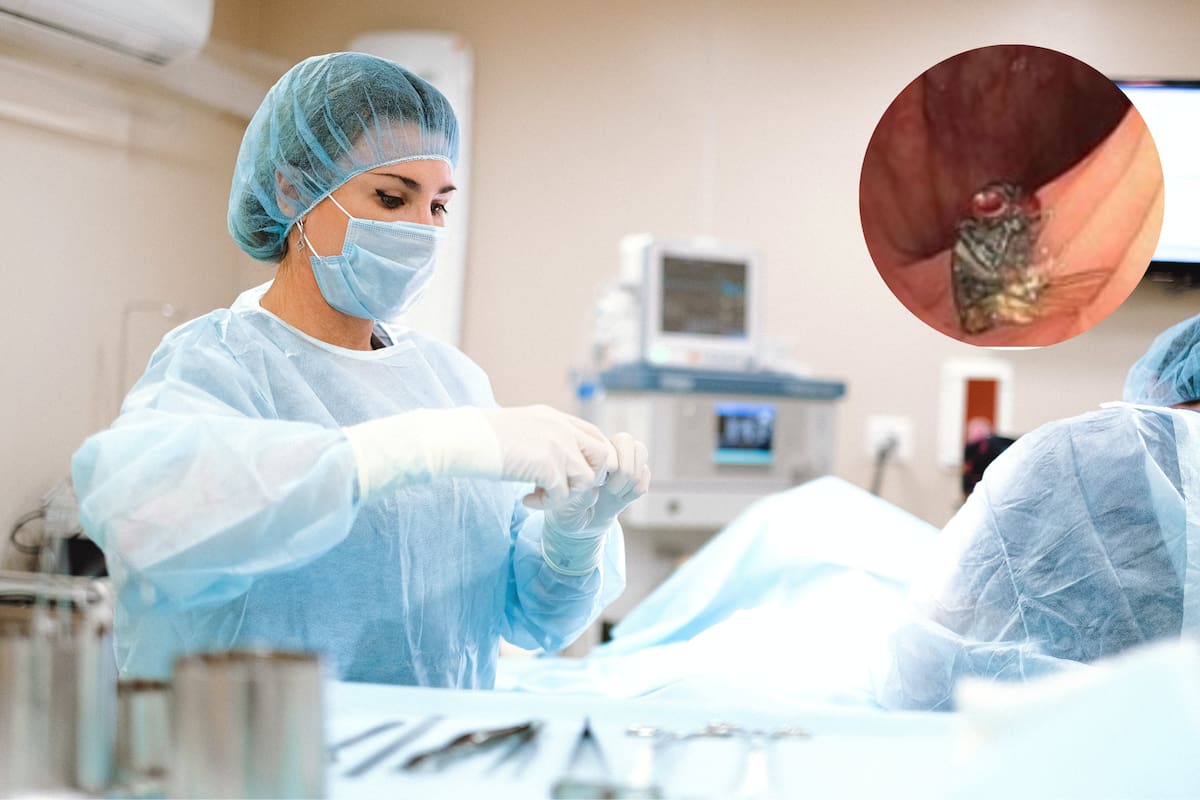 El hallazgo de una mosca casi intacta en el colon de un paciente dejó sin palabras a los médicos de un hospital de EE.UU.