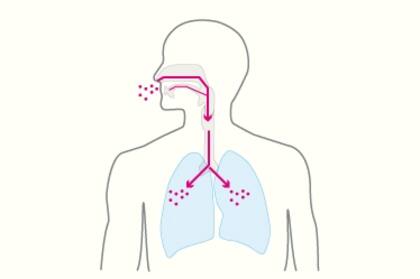 El Hantavirus puede afectar seriamente el sistema respiratorio