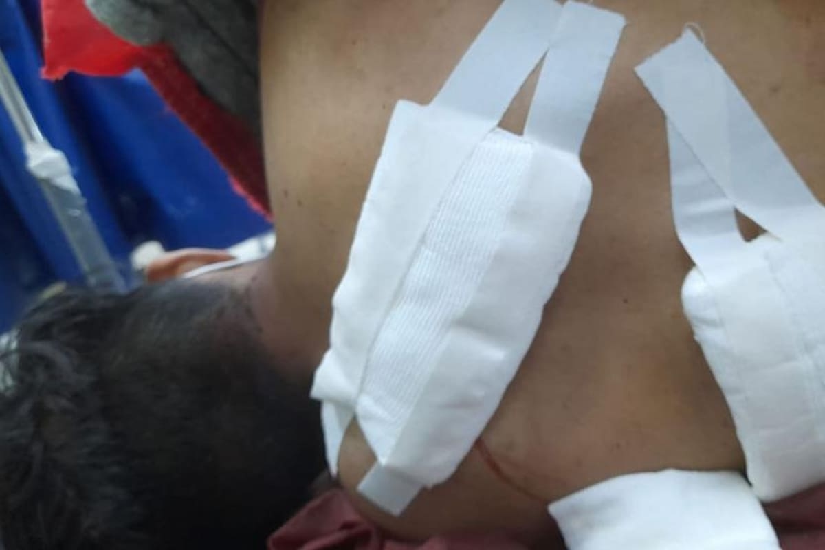 El hijo del carnicero debió ser asistido en un hospital