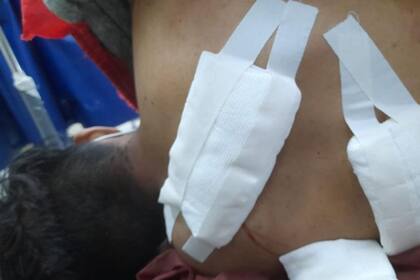 El hijo del carnicero debió ser asistido en un hospital