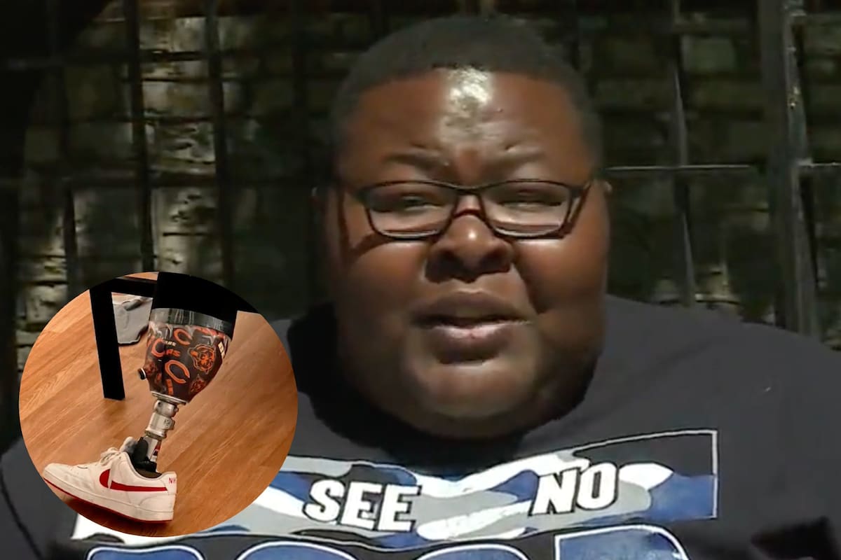 El hombre acusó a la aerolínea de perderle la prótesis de la pierna