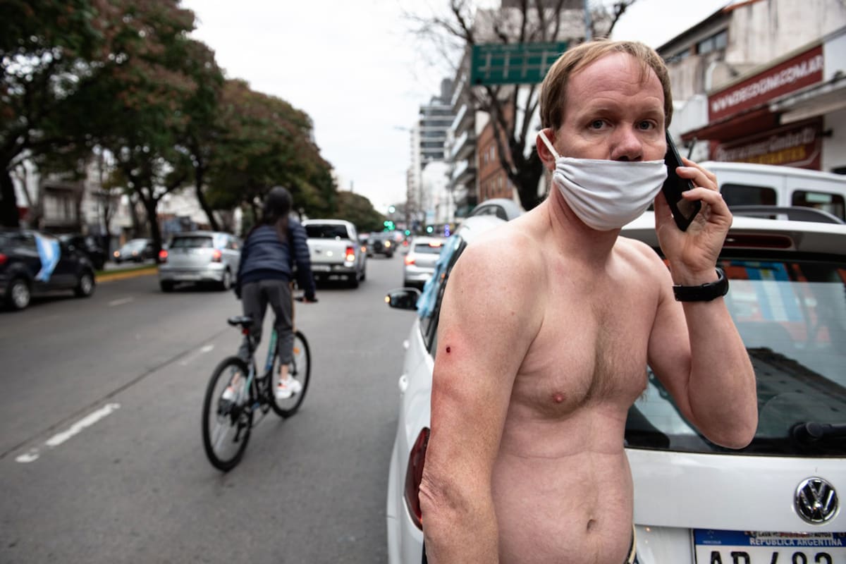 El hombre luego de recibir los disparos se quitó la ropa.