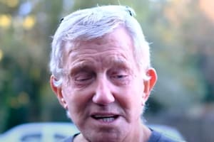 El hombre no puede cerrar correctamente sus ojos hace tres años.