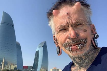 El hombre tiene 61 años y su primera modificación se la hizo cuando tenía 40