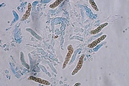 El hongo detectado en el aeropuerto de Houston fue confirmado como Davisoniella eucalypti (Mycosphaerellaceae)