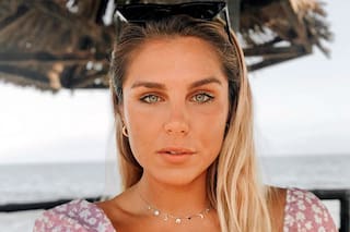 Sorpresa: Ivana Icardi amaneció "desfigurada" durante sus vacaciones por España