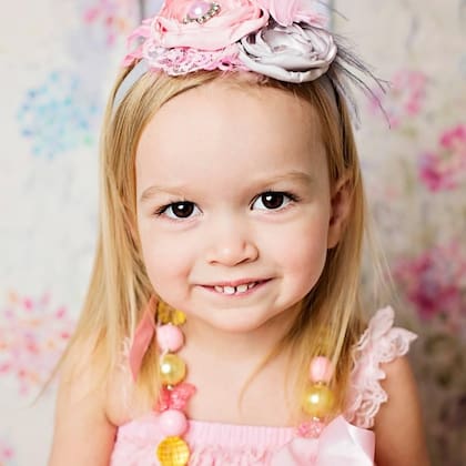 El increíble antes y después de Chloe, la nena que se convirtió en viral con tan solo dos años de edad (Foto: Instagram/@chloeclem)