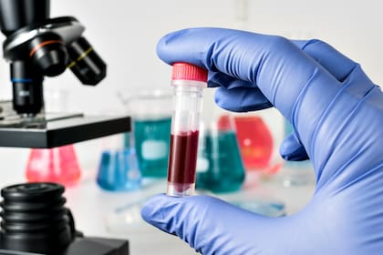 El informe, que elabora cada año la Dirección de Sida, ETS, Hepatitis y TBC de la Secretaría de Salud, analiza las notificaciones nuevas hasta 2017