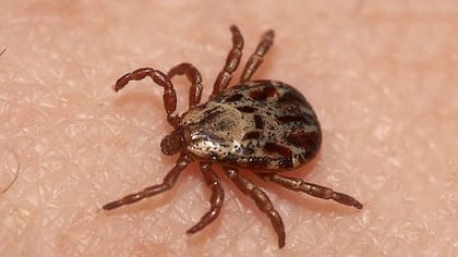 El insecto estaba profundamente adherido a la piel cerca de su tímpano, lo cual provocó un fuerte dolor durante el proceso de extracción (Imagen ilustrativa de Pinterest)