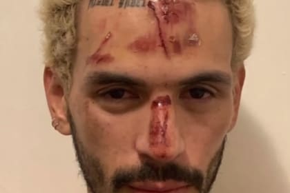 El joven dijo que fue golpeado por ser homosexual