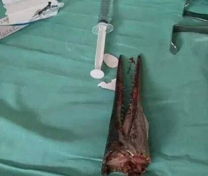 El joven pescador explicó que el pez espada lo atacó porque no toleró la luz de su linterna