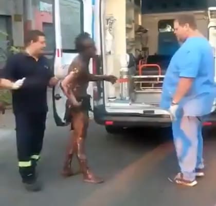 El joven quemado antes de ser trasladado
