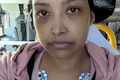 El lupus dañó los riñones de Menco y comenzó a causarle cansancio y dolores que dificultaban su trabajo como azafata