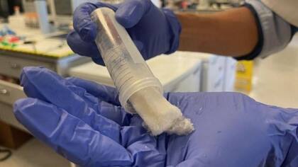 El material de queratina extraído del cabello podría utilizarse para crear dentífricos que reparen el esmalte dental, según los investigadores
