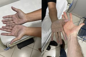 El médico evaluó las patologías posibles y encontró el diagnóstico menos pensado (Captura Twitter @AleGinzo_MD)
