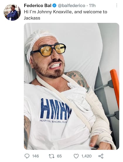 El mensaje de Fede Bal tras accidentarse en Brasil