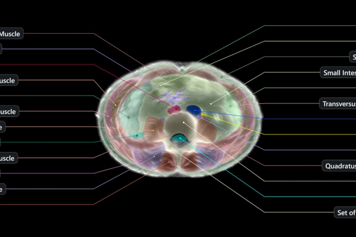 El Midjourney Scanner usa ultrasonido para generar en un minuto una imagen completa del interior del cuerpo humano, al estilo de una resonancia magnética pero mucho más veloz