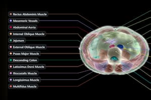 Midjourney cambia de rumbo y presenta un escáner médico supersónico