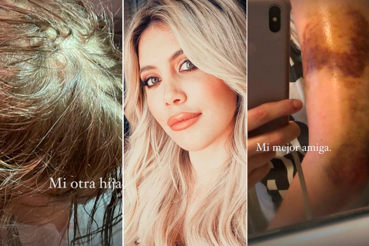 El misterioso accidente de la familia de Wanda Nara