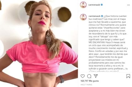 El momento en que Carmen Aub compartió en redes sociales que se había sometido a una explantación de prótesis mamarias