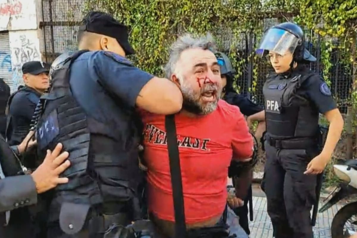 El momento en que demoraron a Facundo Tedeschini, camarógrafo de A24.