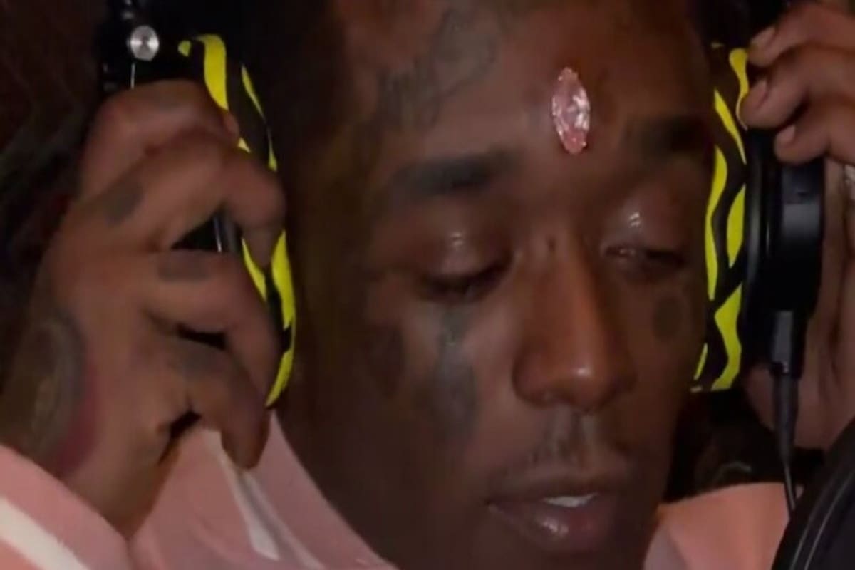 El músico Lil Uzi Vert, de Estados Unidos, publicó un video en sus redes sociales donde mostró la excéntrica transformación corporal a la que se sometió