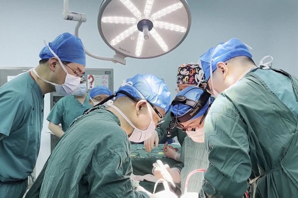 El nexotrasplante se realizó a un paciente de 71 años con cirrosis y cáncer de hígado en el Hospital Universitario de Anhui, en China